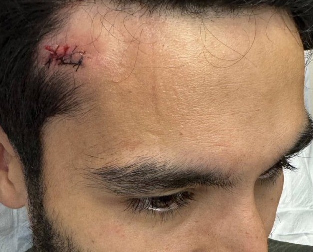 Gündogan recibe cuatro puntos de sutura en la cabeza Gündogan recibe cuatro puntos de sutura en la cabeza