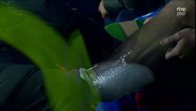 Tras la lesión de Balde... ¡Nueva lesión en la defensa del Barcelona! Tras la lesión de Balde... ¡Nueva lesión en la defensa del Barcelona!